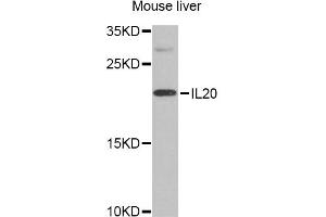 Western blot analysis of extracts of mouse liver, using IL20 Antibody. (IL-20 抗体)