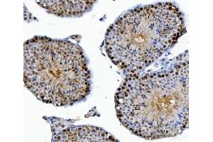 IHC analysis of CSNK2K2 using anti-CSNK2K2 antibody (ABIN7602871).