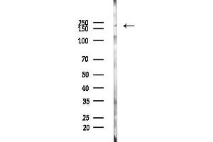 anti-Leucine-Rich Repeat Kinase 1 (LRRK1) (C-Term) antibody