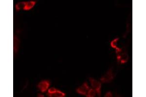 ABIN6274833 staining Hela by IF/ICC. (A4GNT 抗体  (C-Term))