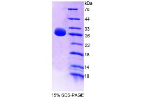 SDS-PAGE (SDS) image for Glutathione S-Transferase mu 4 (GSTM4) (AA 21-215) protein (His tag) (ABIN6238731) (GSTM4 Protein (AA 21-215) (His tag))
