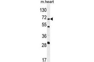 Western blot analysis in mouse heart tissue lysates (35ug/lane)using NT5C1B Antibody (N-term). (NT5C1B 抗体  (N-Term))