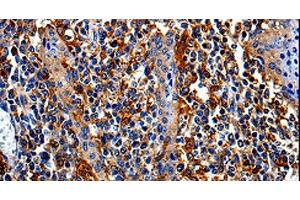 Immunohistochemistry of paraffin-embedded Human tonsil tissue using COX16 Polyclonal Antibody at dilution 1:50 (COX16 抗体)