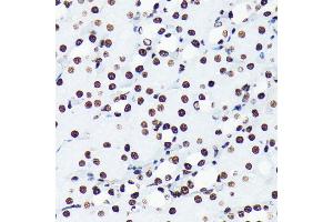 Immunohistochemistry of paraffin-embedded mouse kidney using Acetyl-Histone H4-K5 antibody (ABIN7267743) at dilution of 1:100 (40x lens). (Histone H4 抗体  (acLys5))