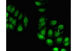 Immunofluorescent analysis of A549 cells using ABIN7142772 at dilution of 1:100 and Alexa Fluor 488-congugated AffiniPure Goat Anti-Rabbit IgG(H+L) (RPL23A 抗体  (AA 1-92))