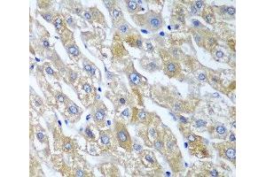 Immunohistochemistry of paraffin-embedded Human liver using SGSH Polyclonal Antibody at dilution of 1:100 (40x lens). (SGSH 抗体)