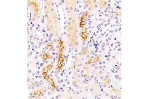 Immunohistochemistry of paraffin embedded mouse kidney using ASBT (ABIN7075648) at dilution of 1:1500 (400x lens) (SLC10A2 抗体)