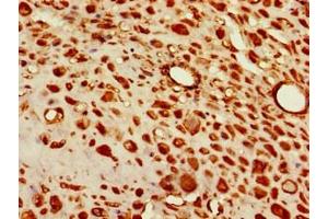 Immunohistochemistry of paraffin-embedded human placenta tissue using ABIN7171322 at dilution of 1:100 (T-Box 6 抗体  (AA 295-436))