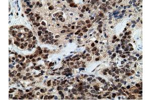 Immunohistochemical staining of paraffin-embedded Human colon tissue using anti-EPM2AIP1 mouse monoclonal antibody.