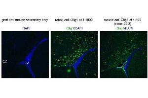 Immunofluorescence of postnatal day 17 mouse corpus callosum (CC) near lateral ventricle (LV).