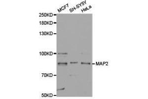 Western Blotting (WB) image for anti-Microtubule-Associated Protein 2 (MAP2) antibody (ABIN1873602) (MAP2 抗体)