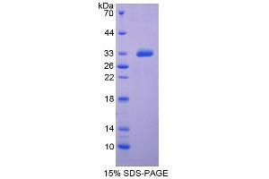 SDS-PAGE analysis of Rat Insulin Like Growth Factor Binding Protein 4 (IGFBP4) Protein. (IGFBP4 蛋白)