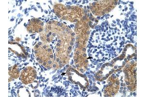 GTF3C5 antibody was used for immunohistochemistry at a concentration of 4-8 ug/ml to stain EpitheliaI cells of renal tubule (arrows) in Human Kidney. (GTF3C5 抗体  (N-Term))