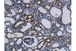 Formalin-fixed and paraffin embedded rat kidney tissue labeled with Anti-Phospho-c-Kit(Tyr721) Polyclonal Antibody, Unconjugated  followed by conjugation to the secondary antibody and DAB staining (KIT 抗体  (pTyr721))