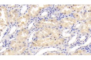 Immunohistochemistry (IHC) image for anti-Peptidyl Arginine Deiminase, Type II (PADI2) antibody (ABIN7441295)