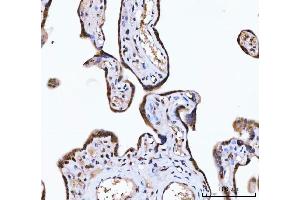 IHC analysis of ZMYND8 using anti-ZMYND8 antibody (ABIN7598947).