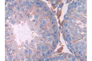 Detection of JAK2 in Rat Testis Tissue using Polyclonal Antibody to Janus Kinase 2 (JAK2) (JAK2 抗体  (AA 916-1103))