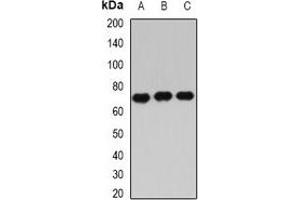 Western blot analysis of IGF2BP3 expression in Hela (A), PC3 (B), NIH3T3 (C) whole cell lysates. (IGF2BP3 抗体)