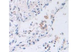 Immunohistochemistry (IHC) image for anti-Prostaglandin E Receptor 2 (Subtype EP2), 53kDa (PTGER2) (AA 155-355) antibody (ABIN1858724)