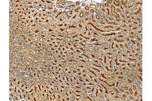 ABIN7094453 and ABIN7098501 at 1/100 staining Mouse kidney tissue by IHC-P. (LOX 抗体  (Internal Region))
