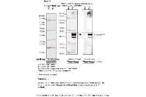 Sample Type: 1. (RAB14 抗体  (C-Term))