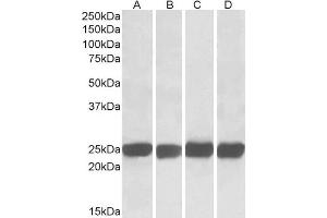 ABIN184670 (0. (GRB2 抗体  (C-Term))