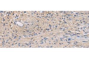 Immunohistochemistry of paraffin-embedded Human brain tissue using PA2G4 Polyclonal Antibody at dilution of 1:60(x200) (PA2G4 抗体)