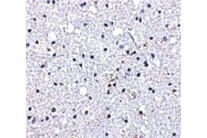 Immunohistochemistry (IHC) image for anti-Duffy Blood Group, Chemokine Receptor (DARC) (N-Term) antibody (ABIN1031343) (DARC 抗体  (N-Term))