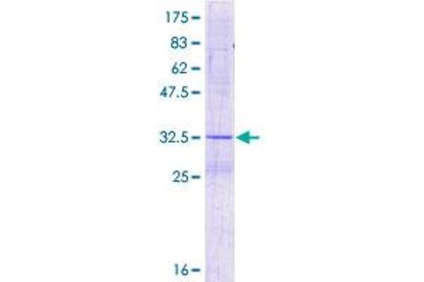 DIO1 Protein (AA 1-61) (GST tag)