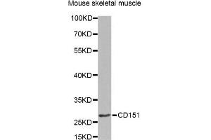 Western blot analysis of extracts of mouse skeletal muscle, using CD151 Antibody. (CD151 抗体)