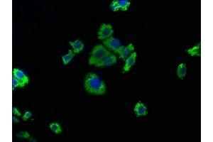 Immunofluorescence staining of HepG2 cells with ABIN7139763 at 1:50, counter-stained with DAPI. (CAPRIN2 抗体  (AA 83-100))