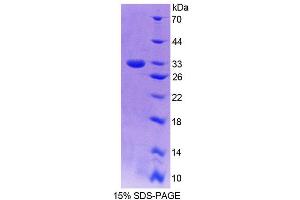 SDS-PAGE (SDS) image for Guanylate Binding Protein 6 (GBP6) (AA 35-277) protein (His tag) (ABIN6239549) (GBP6 Protein (AA 35-277) (His tag))