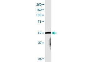Western Blotting (WB) image for anti-Proprotein Convertase Subtilisin/kexin Type 4 (PCSK4) (AA 1-242) antibody (ABIN5648678)