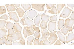 Detection of ACTN3 in Human Skeletal muscle Tissue using Polyclonal Antibody to Actinin Alpha 3 (ACTN3) (ACTN3 抗体  (AA 162-416))