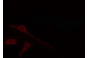 ABIN6274664 staining LOVO cells by IF/ICC. (CYTL1 抗体)