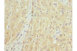Immunohistochemistry of paraffin-embedded human liver tissue using ABIN7155892 at dilution of 1:100 (HGD 抗体  (AA 226-445))