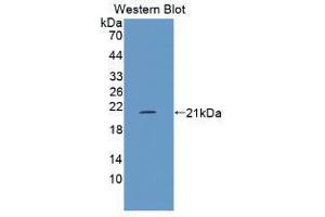 Western blot analysis of the recombinant protein. (FLG2 抗体  (AA 1222-1368))