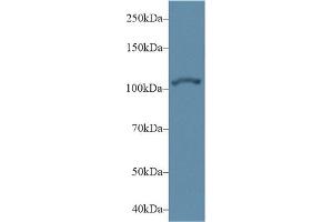 Detection of ACTN2 in Human Hela cell lysate using Polyclonal Antibody to Actinin Alpha 2 (ACTN2) (ACTN2 抗体  (AA 1-254))