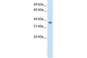 WB Suggested Anti-ZFP36 Antibody Titration:  0. (ZFP36 抗体  (N-Term))