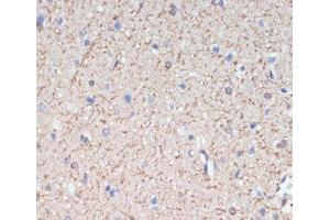 Immunohistochemistry of paraffin-embedded Rat brain using MAG Polyclonal Antibody at dilution of 1:200 (40x lens). (MAG 抗体)