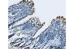 IHC analysis of TLS/FUS using anti-TLS/FUS antibody (ABIN7603099).