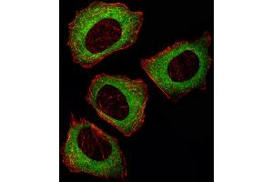 Fluorescent ige of  cell stained with MEK2 (P2K2) Antibody (Center) (ABIN392485 and ABIN2842062)/SA110819AW.
