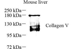 Western blot analysis of collagen alpha-1 (V) (ABIN7073547) at dilution of 1: 500 (Collagen Type V 抗体)