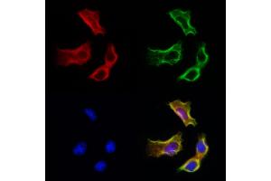 ABIN6265370 and ABIN6272981 staining Hela cells by IF/ICC. (SULT1E1 抗体  (Internal Region))