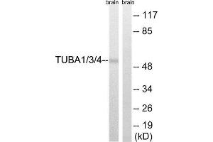 Western Blotting (WB) image for anti-TUBA1/3/4 (Tyr272) antibody (ABIN1848392) (TUBA1/3/4 (Tyr272) 抗体)