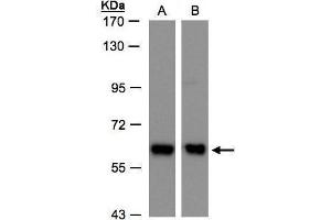WB Image Sample(30 ug whole cell lysate) A:H1299 B:Hep G2, 7. (ARCN1 抗体)