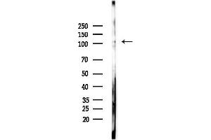 Western blot analysis of lysates from EC304 cells(heat-shock,45 min treatment), using CACN Antibody at 1/1000 dilution.