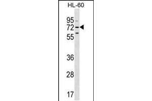Western blot analysis in HL-60 cell line lysates (35ug/lane). (MBTD1 抗体  (C-Term))