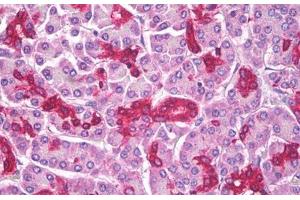 Anti-ABCD1 antibody IHC staining of human pancreas. (ABCD1 抗体)