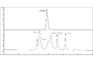 High Pressure Liquid Chromatography (HPLC) image for Interleukin 2 Receptor, alpha (IL2RA) (AA 22-213) (Active) protein (Fc Tag) (ABIN2181381)